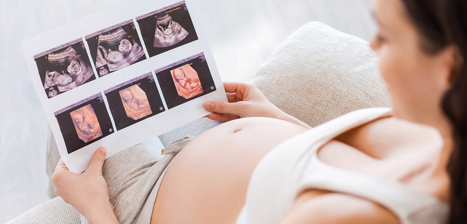 Ультразвуковое скрининговое исследование 30-34 недели. Скрининг III.  Многоплодная беременность